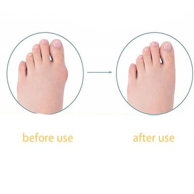 TPR Adult Big Foot Straightener Bunion Коррекция дня/ночи Детский пальцевой палец Straightener для обуви